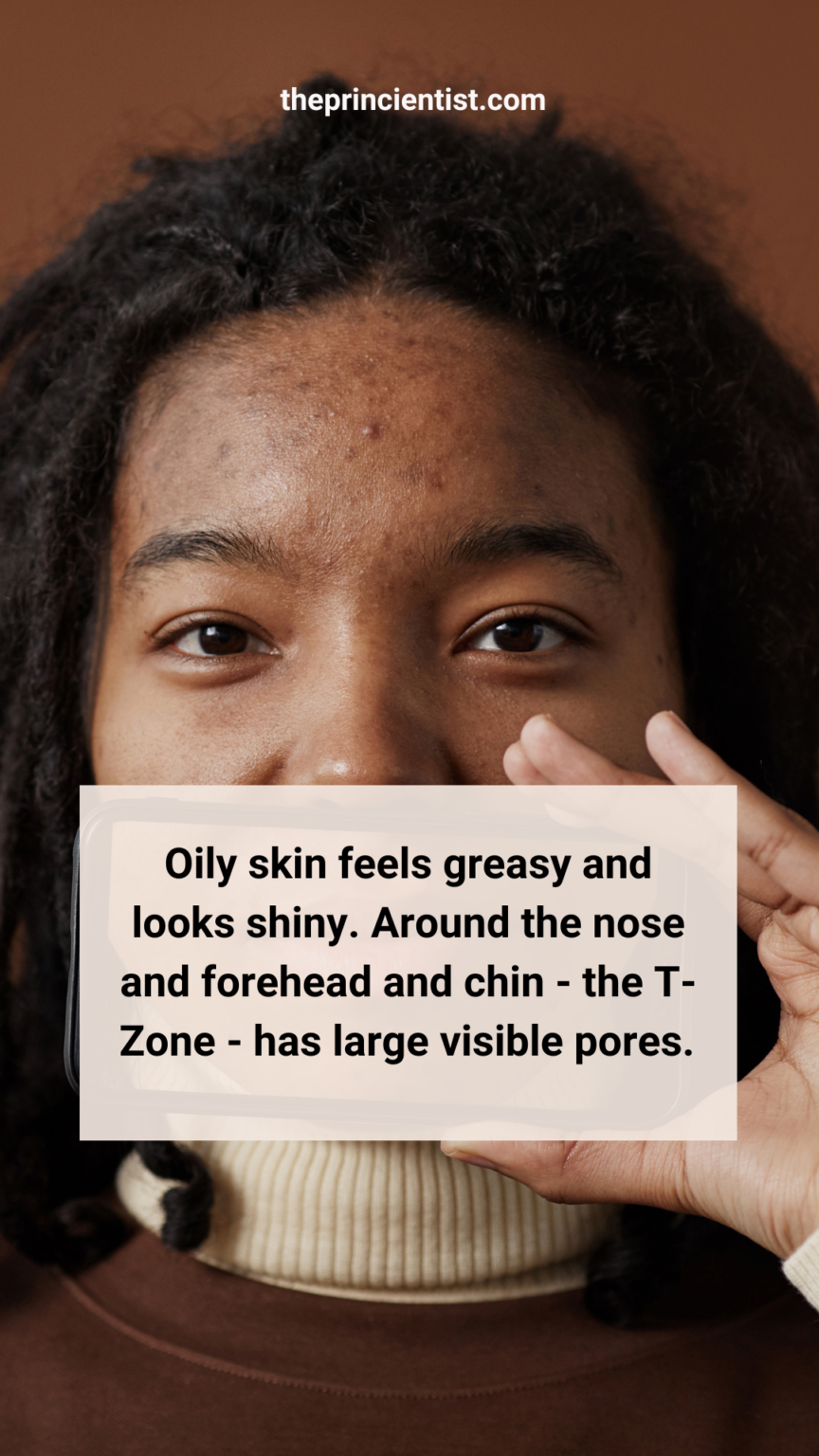 what is your skin type - quote 2 - woman with oily skin with big pores and acne
